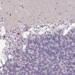 MXRA8 Antibody in Immunohistochemistry (IHC)