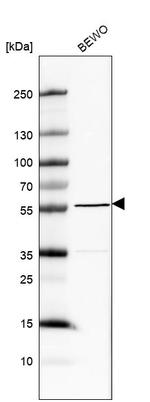 MXRA8 Antibody in Western Blot (WB)