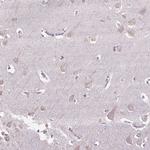 GBX1 Antibody in Immunohistochemistry (Paraffin) (IHC (P))