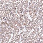 GBX1 Antibody in Immunohistochemistry (Paraffin) (IHC (P))