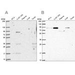 PLOD1 Antibody in Western Blot (WB)