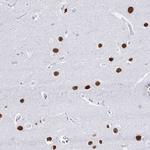 RALYL Antibody in Immunohistochemistry (Paraffin) (IHC (P))