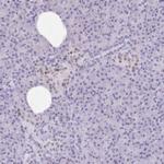 RALYL Antibody in Immunohistochemistry (Paraffin) (IHC (P))