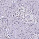 RALYL Antibody in Immunohistochemistry (IHC)