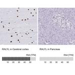 RALYL Antibody