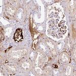 Apolipoprotein C2 Antibody in Immunohistochemistry (Paraffin) (IHC (P))