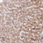 Apolipoprotein C2 Antibody in Immunohistochemistry (Paraffin) (IHC (P))