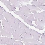 Apolipoprotein C2 Antibody in Immunohistochemistry (Paraffin) (IHC (P))