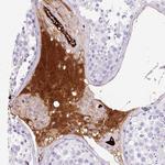 Apolipoprotein C2 Antibody in Immunohistochemistry (Paraffin) (IHC (P))