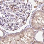 RPS5 Antibody in Immunohistochemistry (IHC)