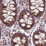 RPS5 Antibody in Immunohistochemistry (IHC)