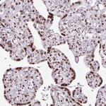 Histone H1.3 Antibody in Immunohistochemistry (Paraffin) (IHC (P))