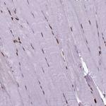 Histone H1.3 Antibody in Immunohistochemistry (Paraffin) (IHC (P))