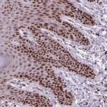 Histone H1.3 Antibody in Immunohistochemistry (Paraffin) (IHC (P))