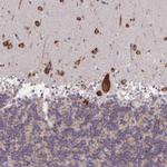 MIA3 Antibody in Immunohistochemistry (Paraffin) (IHC (P))