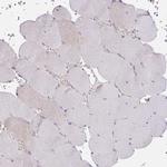 MIA3 Antibody in Immunohistochemistry (Paraffin) (IHC (P))