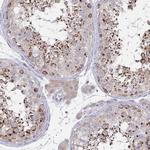 MIA3 Antibody in Immunohistochemistry (IHC)