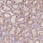 NUDT3 Antibody in Immunohistochemistry (Paraffin) (IHC (P))