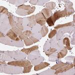 NUDT3 Antibody in Immunohistochemistry (Paraffin) (IHC (P))