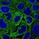 MBOAT7 Antibody in Immunocytochemistry (ICC/IF)