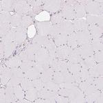 MBOAT7 Antibody in Immunohistochemistry (Paraffin) (IHC (P))