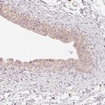 MBOAT7 Antibody in Immunohistochemistry (Paraffin) (IHC (P))