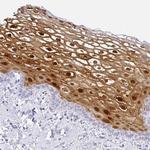 SERPINB3 Antibody in Immunohistochemistry (Paraffin) (IHC (P))