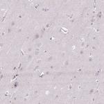 KIFC1 Antibody in Immunohistochemistry (Paraffin) (IHC (P))