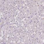 KIFC1 Antibody in Immunohistochemistry (Paraffin) (IHC (P))