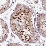 KIFC1 Antibody in Immunohistochemistry (Paraffin) (IHC (P))