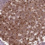 KIFC1 Antibody in Immunohistochemistry (Paraffin) (IHC (P))