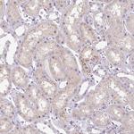 HEXB Antibody in Immunohistochemistry (IHC)