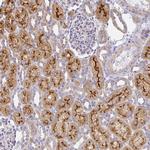 FLRT3 Antibody in Immunohistochemistry (Paraffin) (IHC (P))