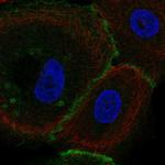 FLRT3 Antibody in Immunocytochemistry (ICC/IF)