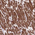 MBTPS1 Antibody in Immunohistochemistry (Paraffin) (IHC (P))