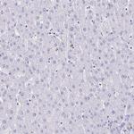 RNASE3 Antibody in Immunohistochemistry (Paraffin) (IHC (P))