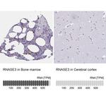 RNASE3 Antibody in Immunohistochemistry (IHC)