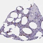 RNASE3 Antibody in Immunohistochemistry (IHC)