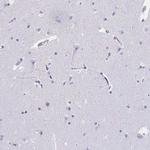 RNASE3 Antibody in Immunohistochemistry (IHC)