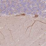 NDST3 Antibody in Immunohistochemistry (IHC)