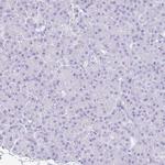 NSG2 Antibody in Immunohistochemistry (IHC)