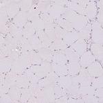 GRID2 Antibody in Immunohistochemistry (Paraffin) (IHC (P))