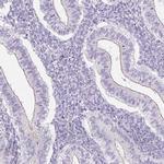 GRID2 Antibody in Immunohistochemistry (IHC)