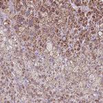 SCO2 Antibody in Immunohistochemistry (IHC)