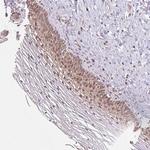 MMS19 Antibody in Immunohistochemistry (Paraffin) (IHC (P))