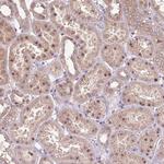 MMS19 Antibody in Immunohistochemistry (Paraffin) (IHC (P))