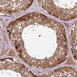 MMS19 Antibody in Immunohistochemistry (Paraffin) (IHC (P))