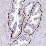 LRRC26 Antibody in Immunohistochemistry (Paraffin) (IHC (P))