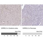 KIRREL3 Antibody in Immunohistochemistry (IHC)