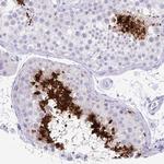 PRM2 Antibody in Immunohistochemistry (Paraffin) (IHC (P))